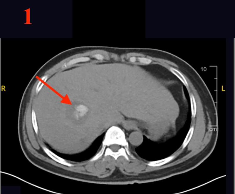 Figure 1a
