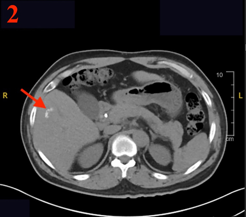 Figure 1b