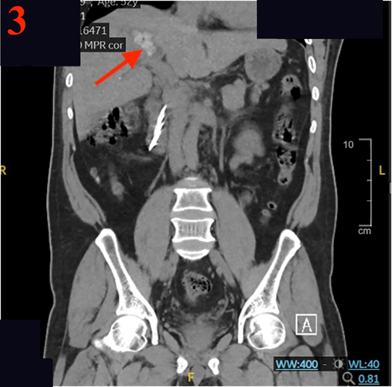Figure 2a