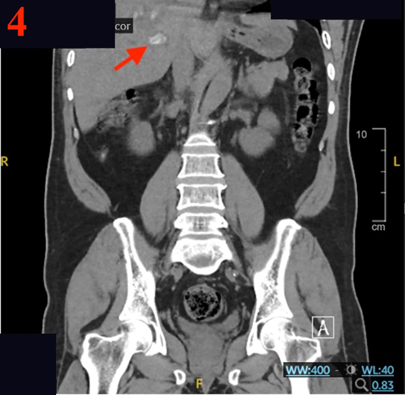 Figure 2b