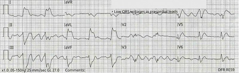 Figure 1a