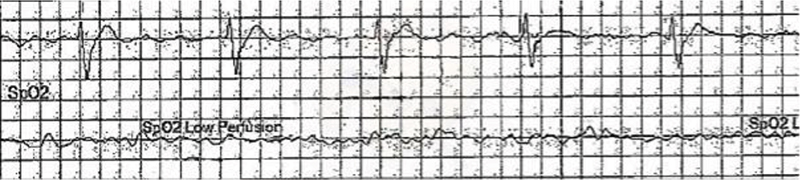 Figure 1b