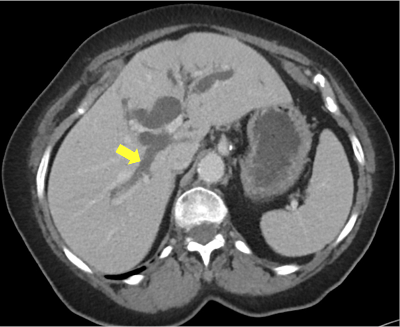 Figure 1a