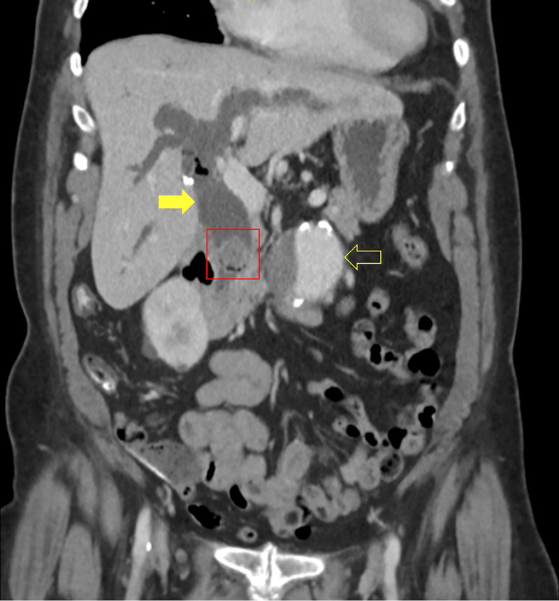Figure 1b