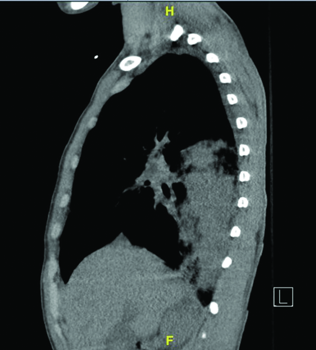 Figure 1D